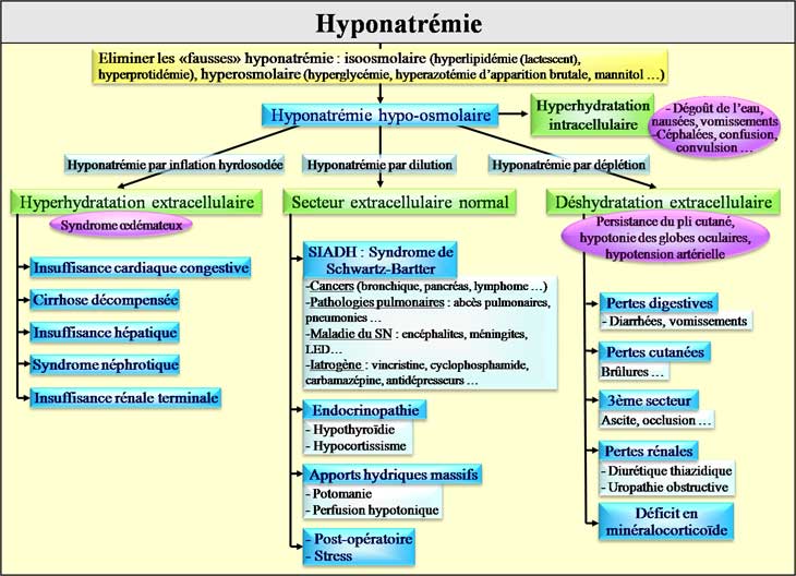 Etiologies d'une hyponatrémie