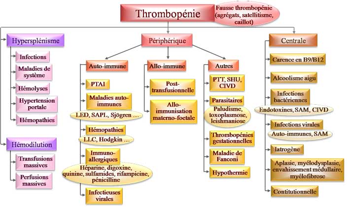 Etiologies d'une thrombopénie