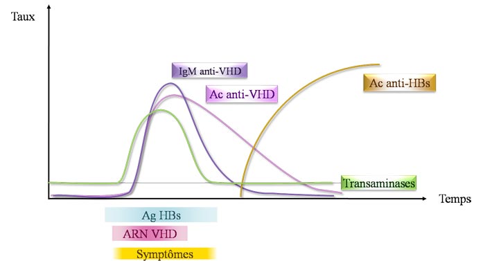 sérologie d'une infection VHB - VHD aiguë